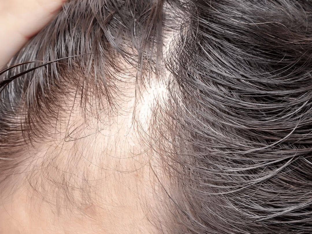 Uneven Tone